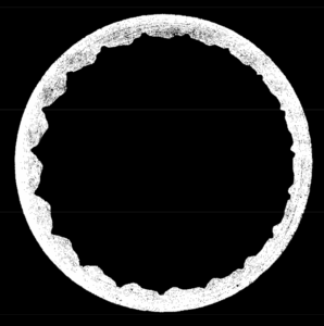 Teethcompletelyworn 2 Teeth completely worn